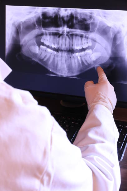 Best Emergency Gum Treatment in Bellevue, OH