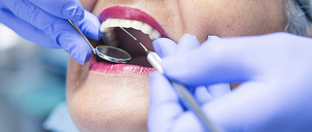 Best Emergency Tooth Extraction in Bellevue, OH